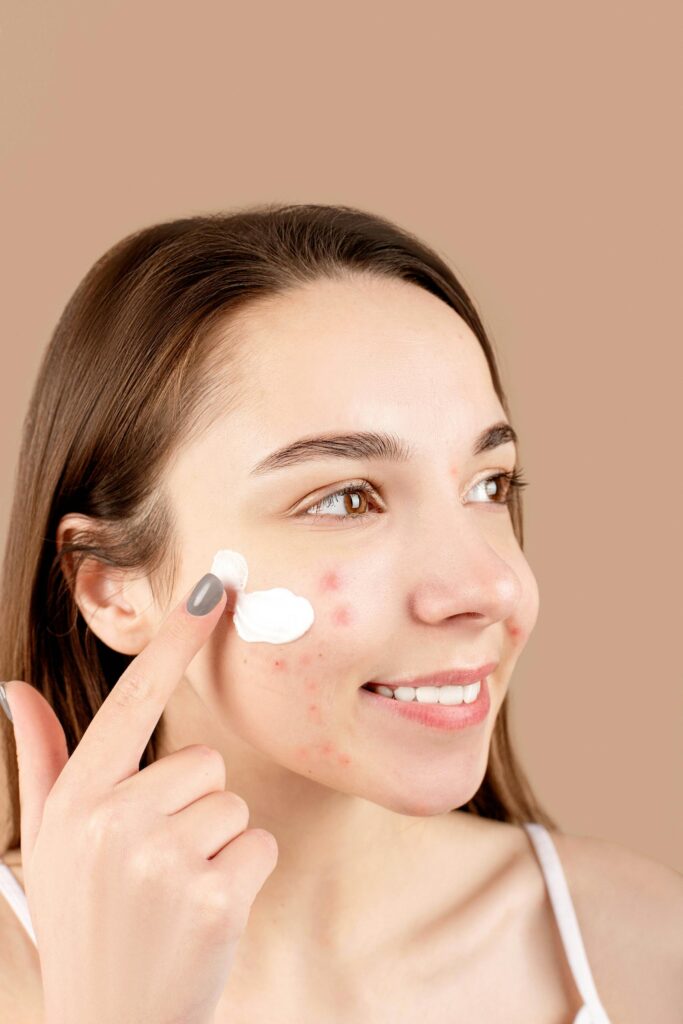 Unlock Clear Skin with Zinamax: The Revolutionary Solution for Acne Woes